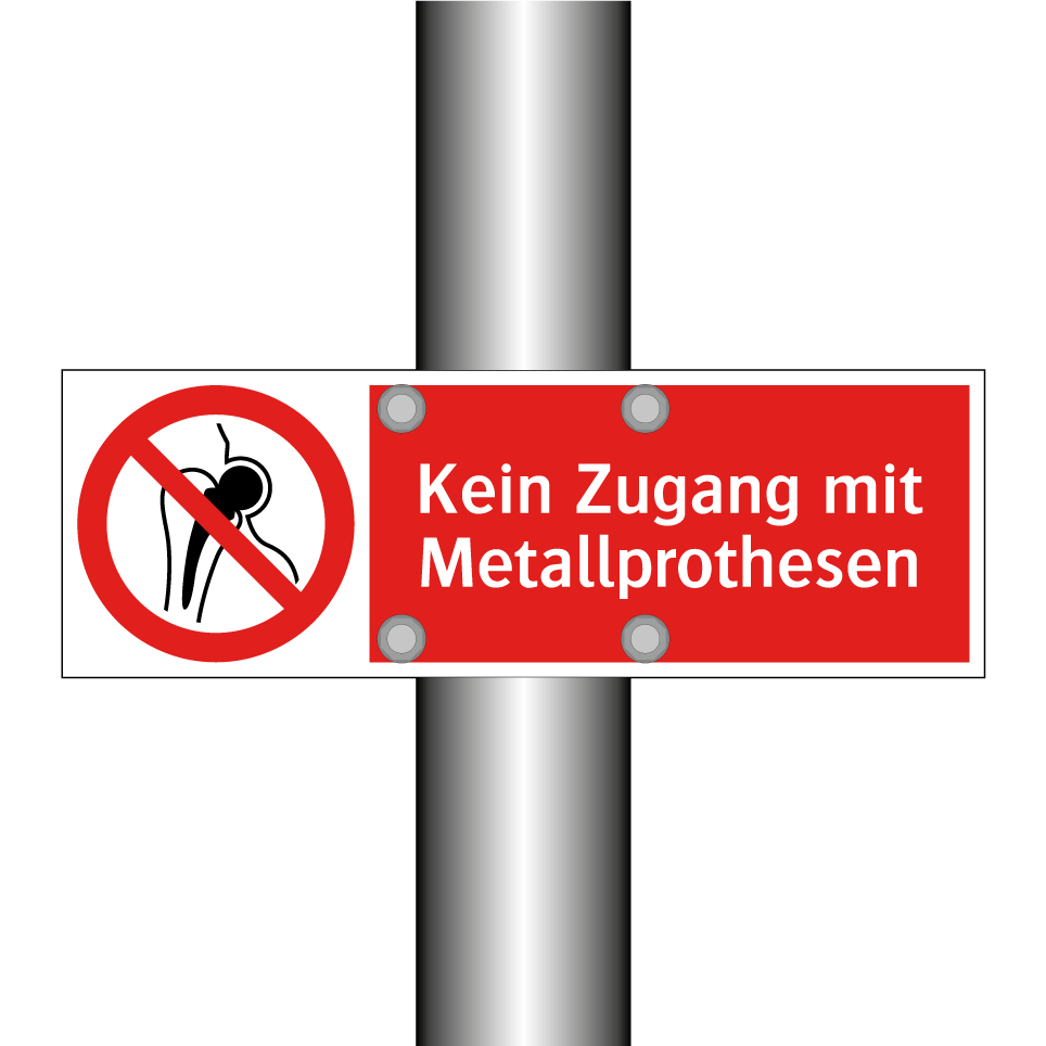 Kein Zugang mit Metallprothesen